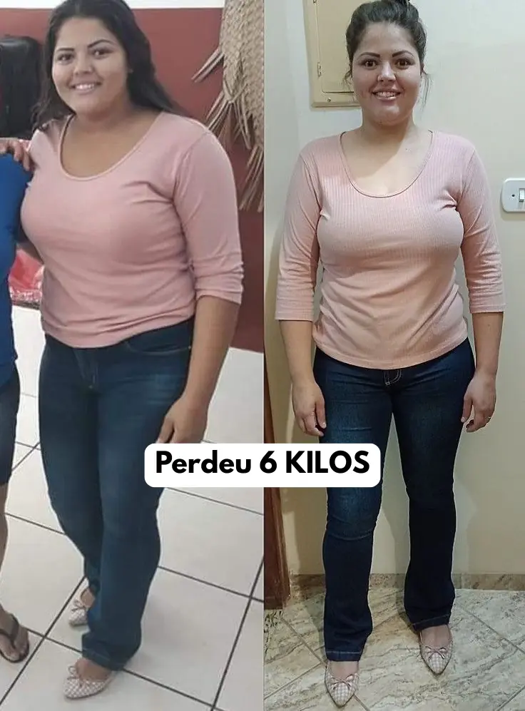 Comparação antes e depois de Mariana, 29 anos