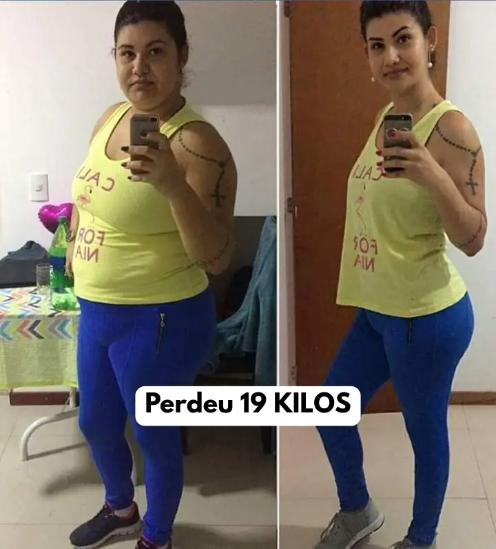 Comparação antes e depois de Fernanda, 35 anos